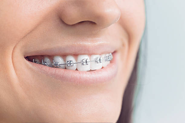 Best Dentures (Full and Partial)  in Dover, FL